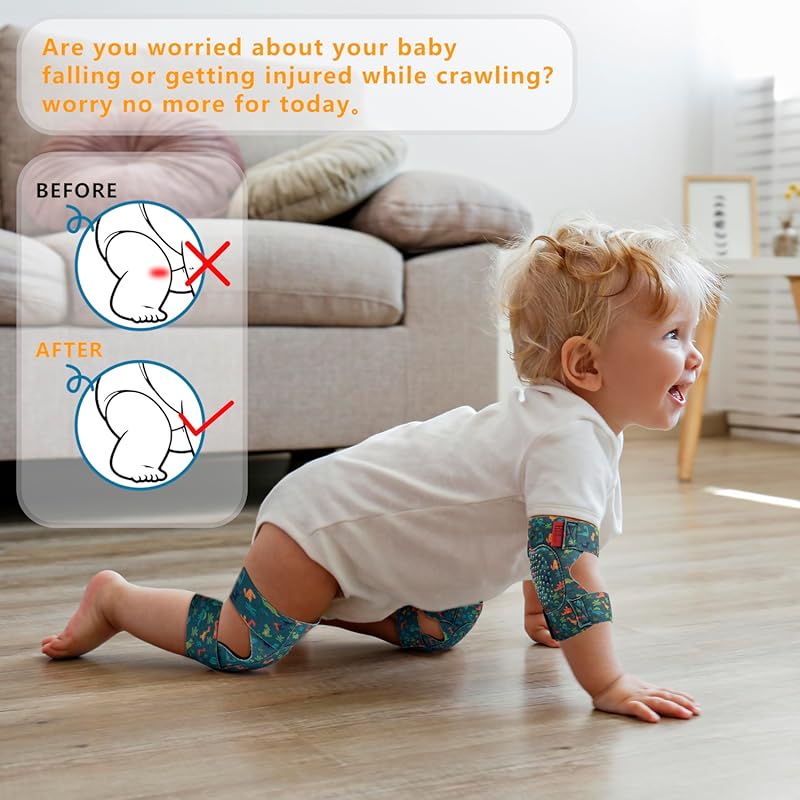 Adjustable Baby Knee Pads (2 Pairs) for Crawling - Infant & Toddler Kn