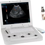 Our Top 10 Best Doppler Fetal Monitor: Expert Picks for Clarity