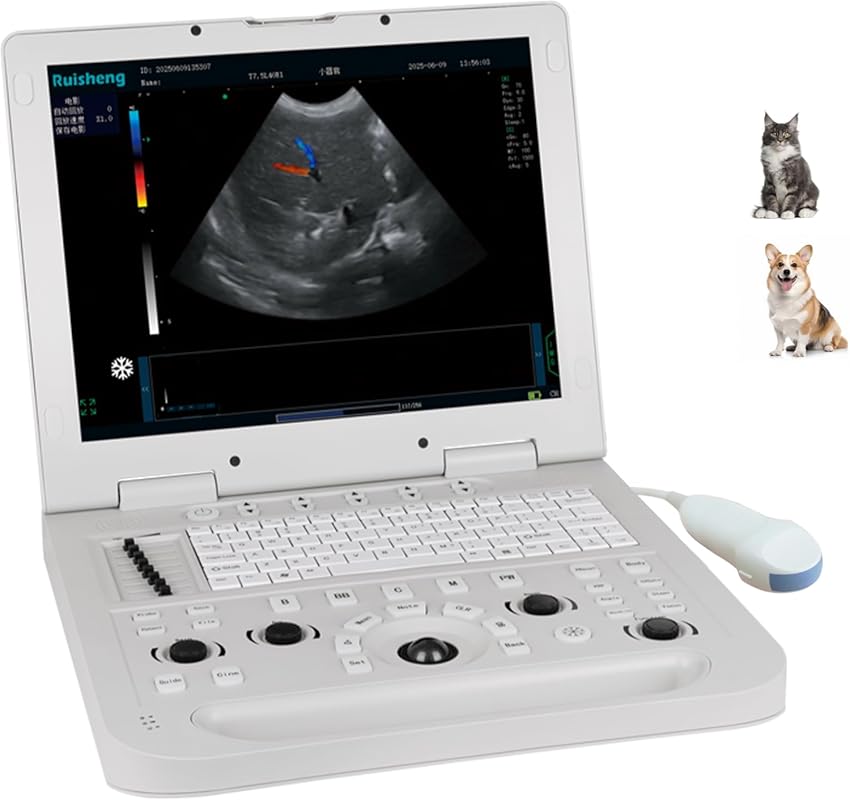 Our Top 10 Best Doppler Fetal Monitor: Expert Picks for Clarity
